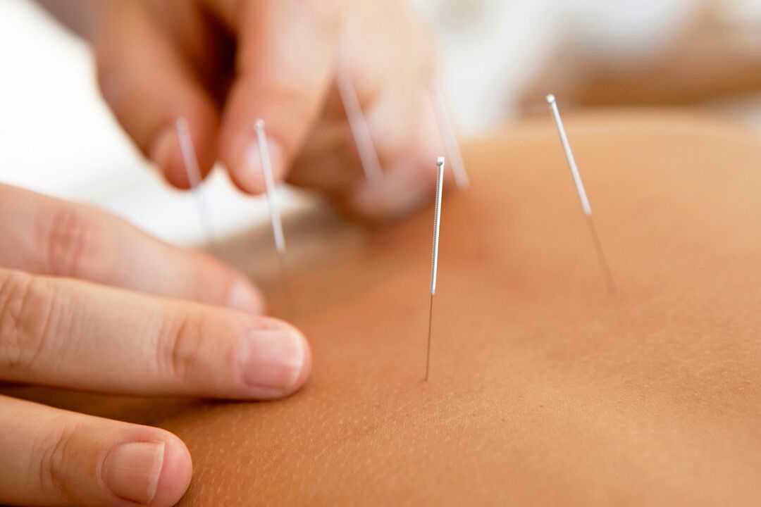 acupuncture to increase strength