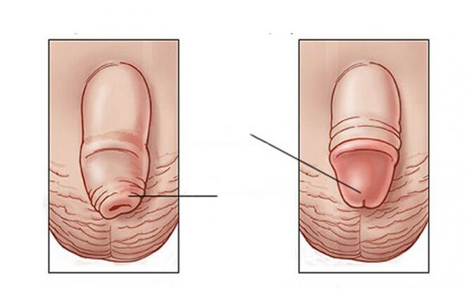 What task does the lubricant perform