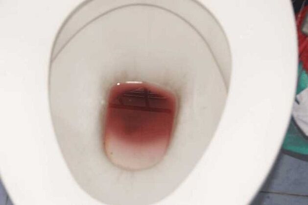 spots on men when they are excited